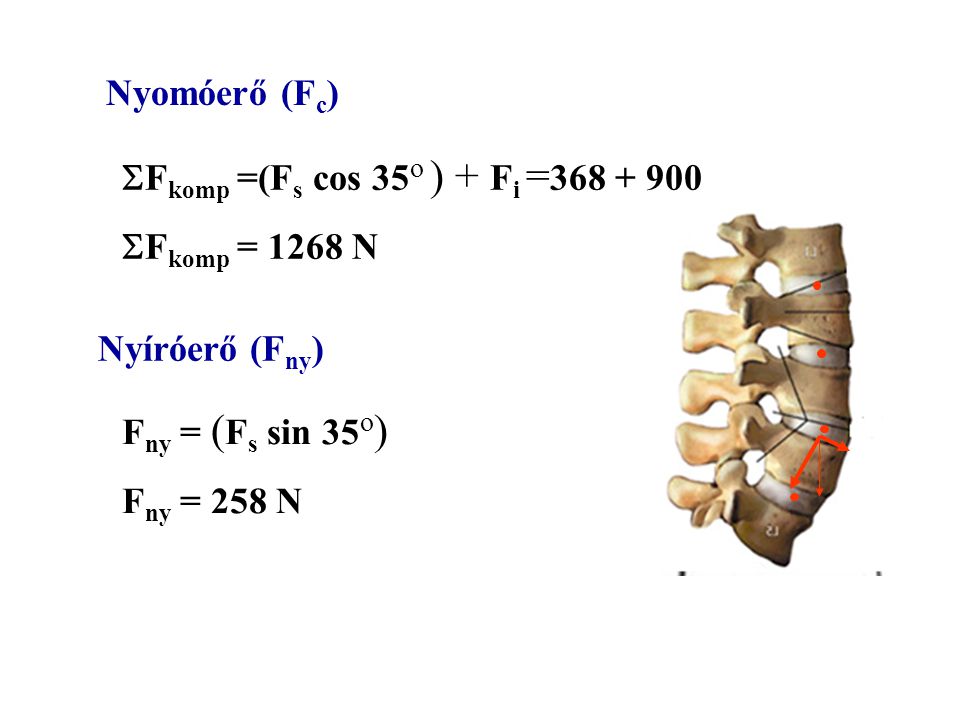 Nyomóerő (Fc) Fkomp =(Fs cos 35o ) + Fi = Fkomp = 1268 N. Nyíróerő (Fny) Fny = (Fs sin 35o)