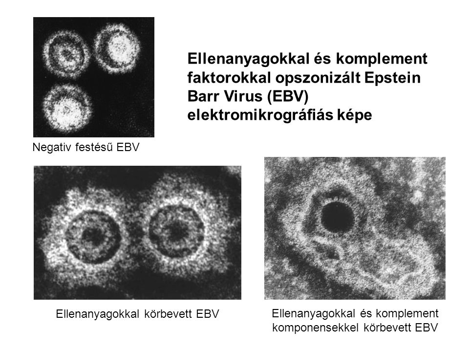 Ellenanyagokkal és komplement faktorokkal opszonizált Epstein Barr Virus (EBV) elektromikrográfiás képe