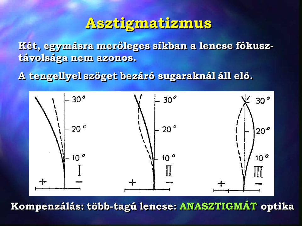 Asztigmatizmus Két, egymásra merőleges síkban a lencse fókusz-távolsága nem azonos. A tengellyel szöget bezáró sugaraknál áll elő.