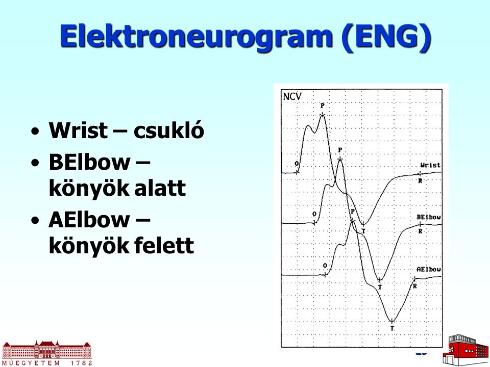 Elektroneurogram (ENG)