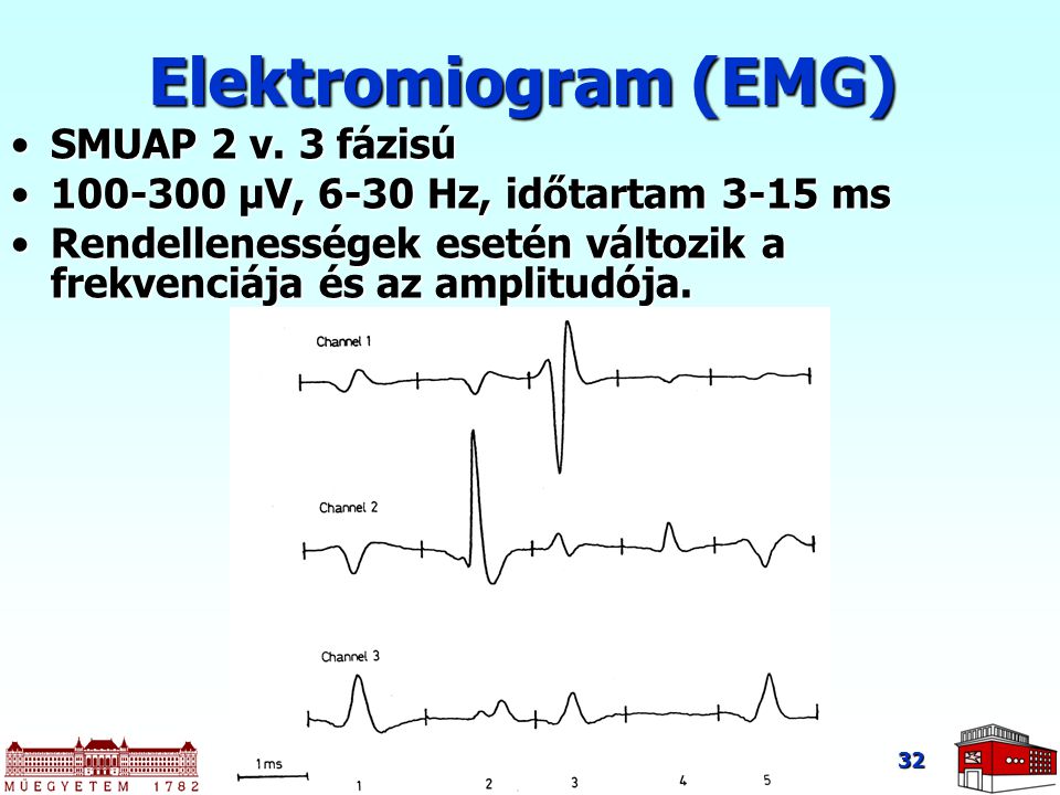 Elektromiogram (EMG) SMUAP 2 v. 3 fázisú