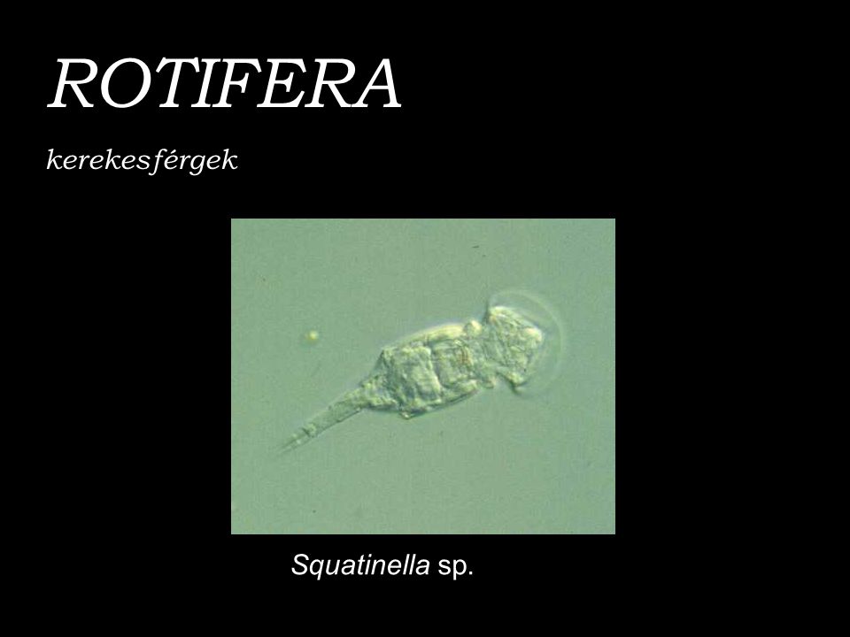 ROTIFERA kerekesférgek Squatinella sp.