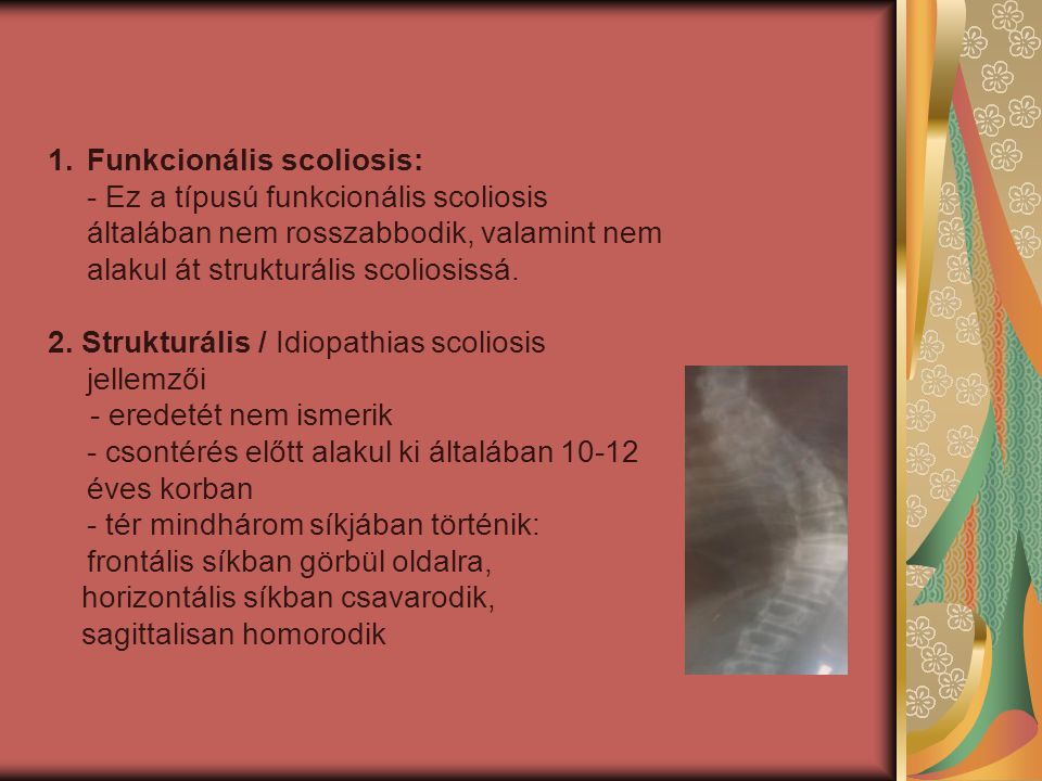 Funkcionális scoliosis: