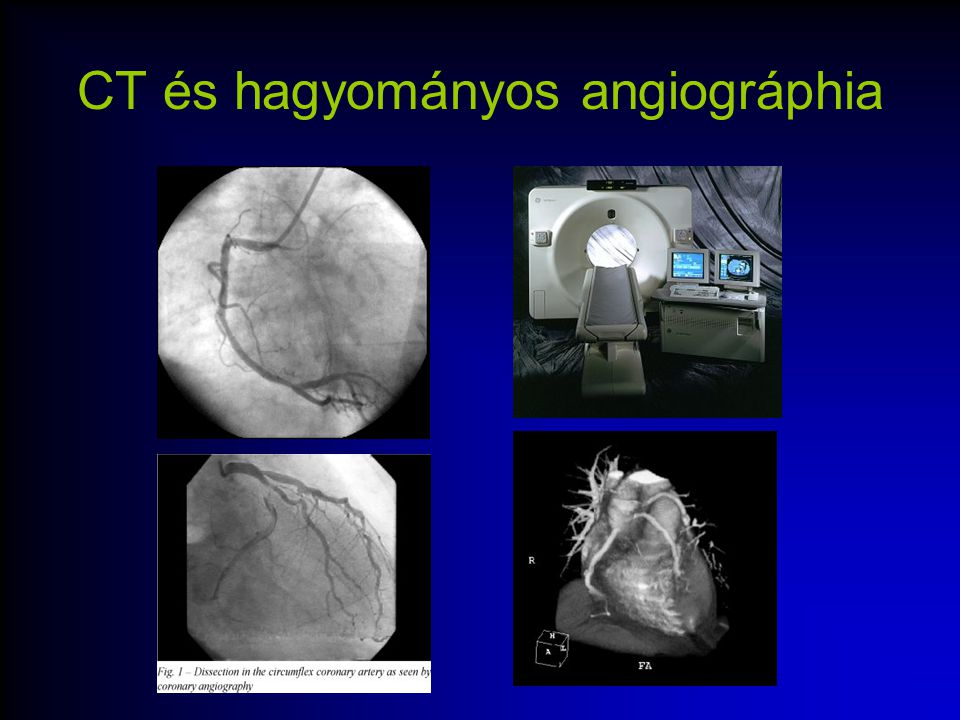 CT és hagyományos angiográphia