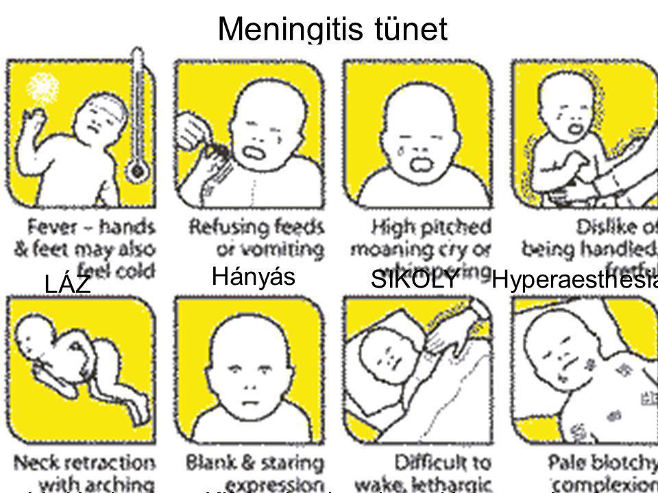 Meningitis tünet Hányás SIKOLY Hyperaesthesia LÁZ Vadászkutya