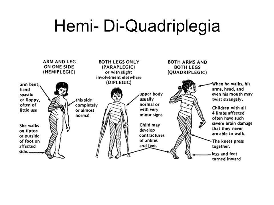 Hemi- Di-Quadriplegia