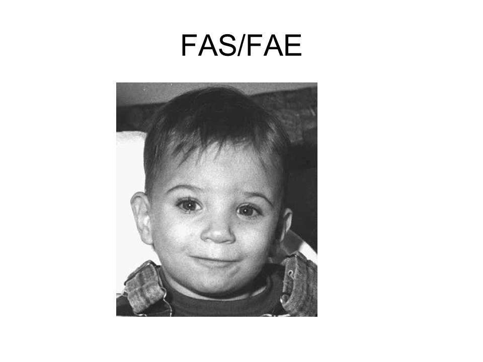 FAS/FAE