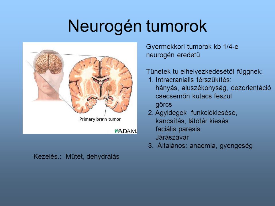 Neurogén tumorok Gyermekkori tumorok kb 1/4-e neurogén eredetű