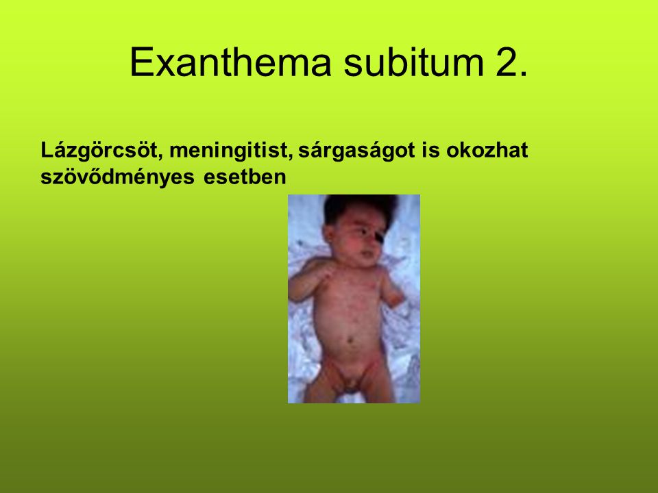Exanthema subitum 2. Lázgörcsöt, meningitist, sárgaságot is okozhat szövődményes esetben