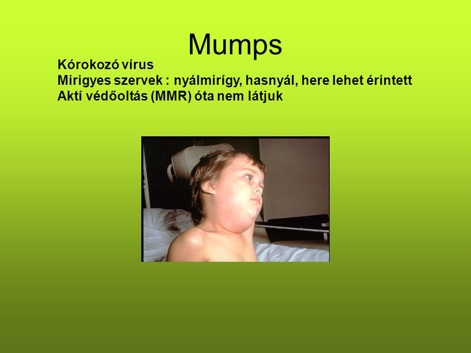 Mumps Kórokozó vírus. Mirigyes szervek : nyálmirígy, hasnyál, here lehet érintett.