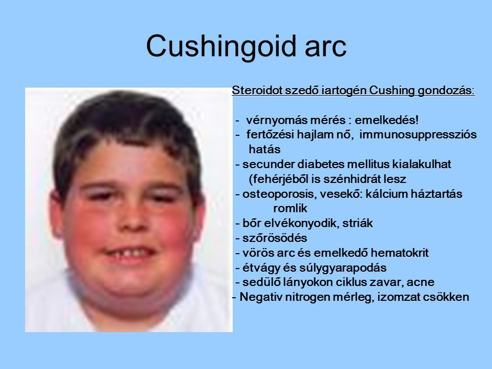 Cushingoid arc Steroidot szedő iartogén Cushing gondozás: