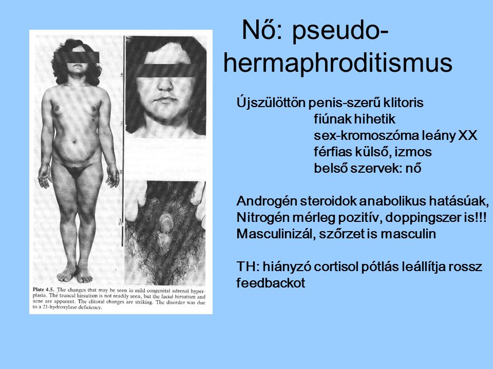 Nő: pseudo- hermaphroditismus
