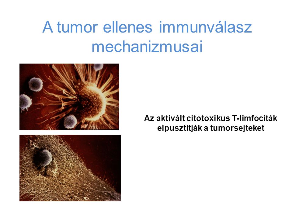 Az aktivált citotoxikus T-limfociták elpusztítják a tumorsejteket