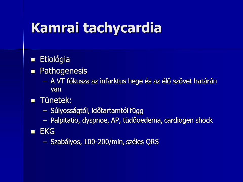 Kamrai tachycardia Etiológia Pathogenesis Tünetek: EKG