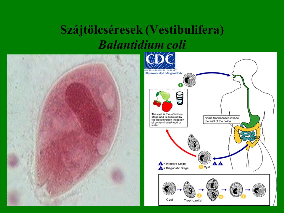 Szájtölcséresek (Vestibulifera) Balantidium coli