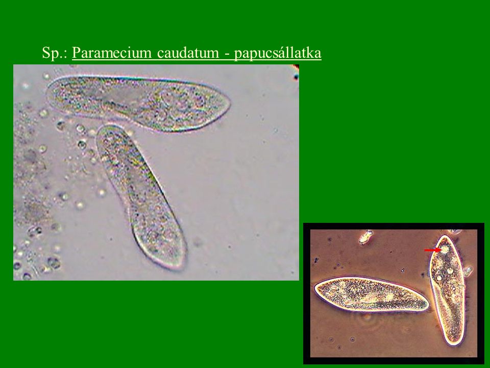 Sp.: Paramecium caudatum - papucsállatka