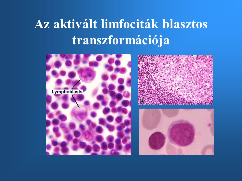 Az aktivált limfociták blasztos transzformációja