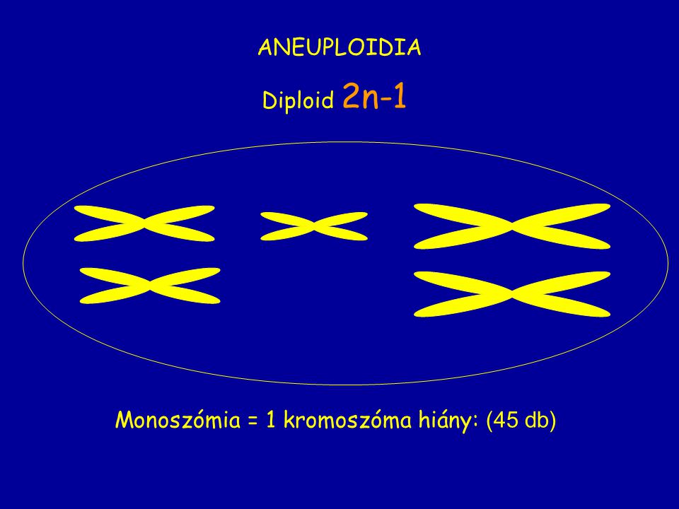 ANEUPLOIDIA Diploid 2n-1 Monoszómia = 1 kromoszóma hiány: (45 db)