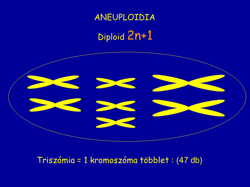 ANEUPLOIDIA Diploid 2n+1 Triszómia = 1 kromoszóma többlet : (47 db)