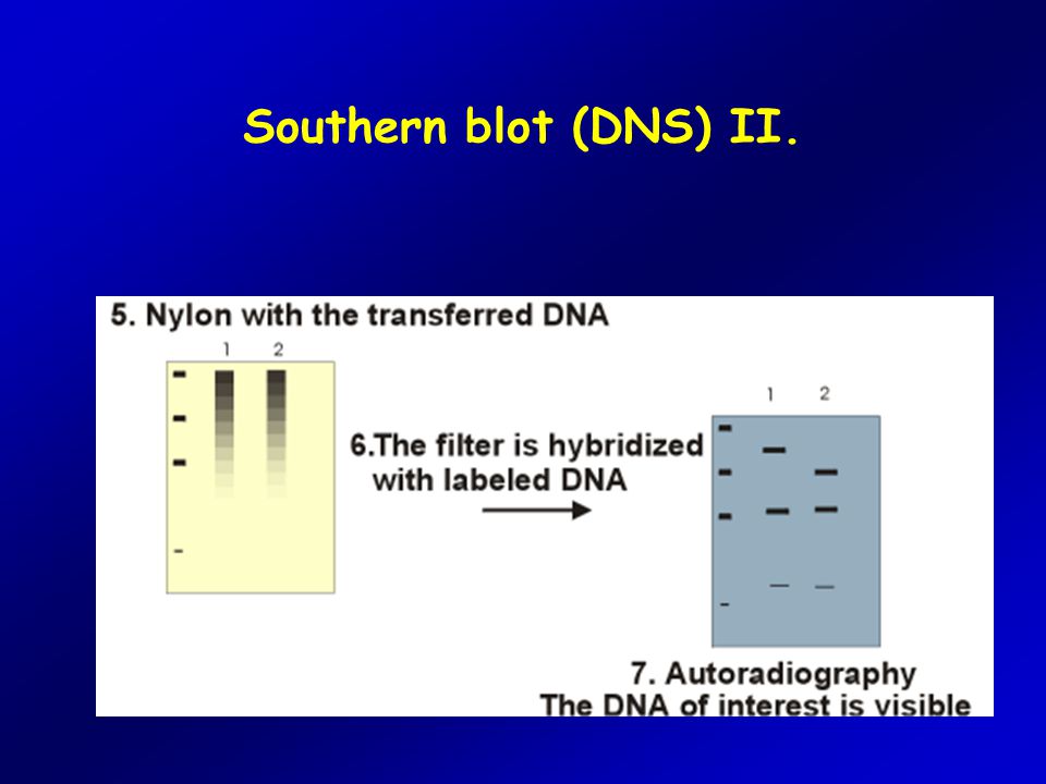 Southern blot (DNS) II.