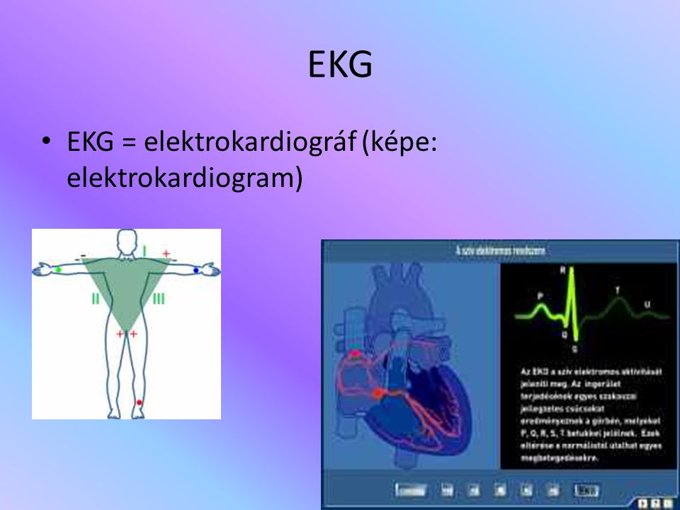 EKG EKG = elektrokardiográf (képe: elektrokardiogram)