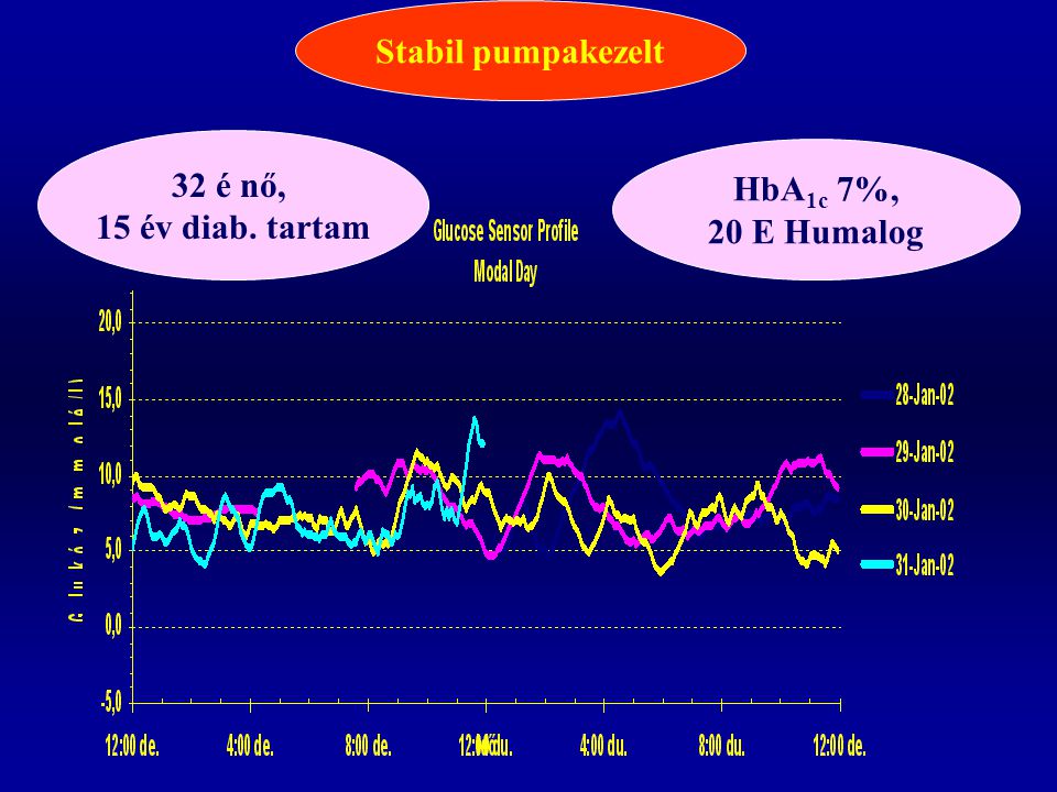 Stabil pumpakezelt 32 é nő, 15 év diab. tartam HbA1c 7%, 20 E Humalog