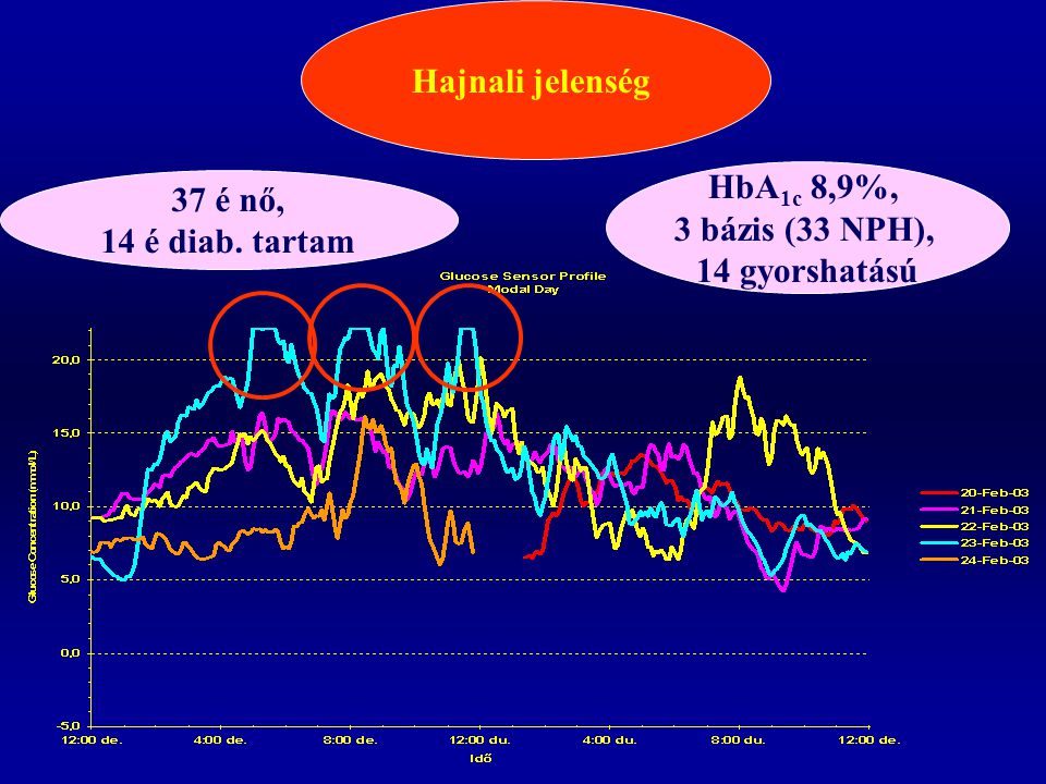 Hajnali jelenség HbA1c 8,9%, 3 bázis (33 NPH), 14 gyorshatású 37 é nő, 14 é diab. tartam