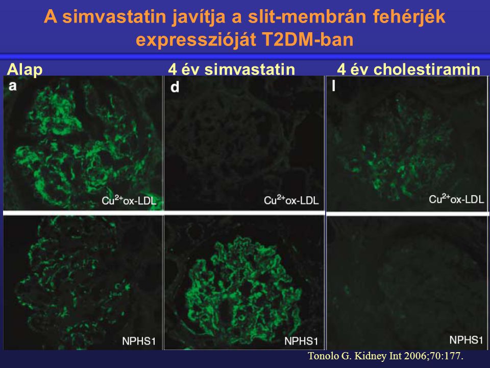 A simvastatin javítja a slit-membrán fehérjék expresszióját T2DM-ban