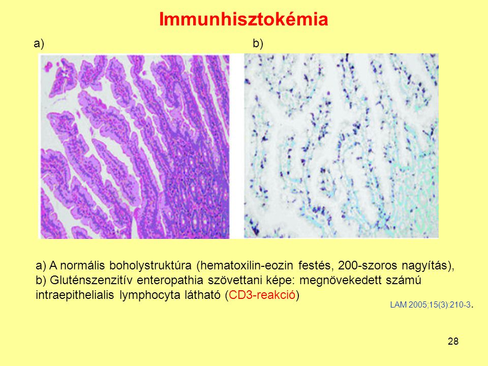 Immunhisztokémia a) b)