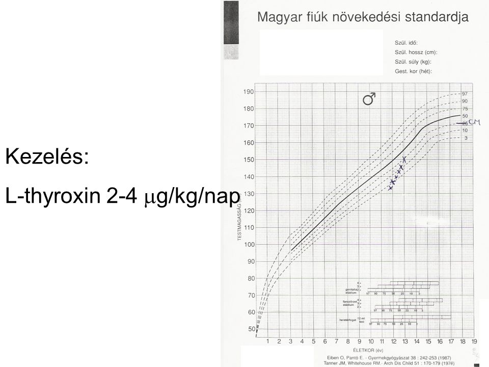 Kezelés: L-thyroxin 2-4 g/kg/nap
