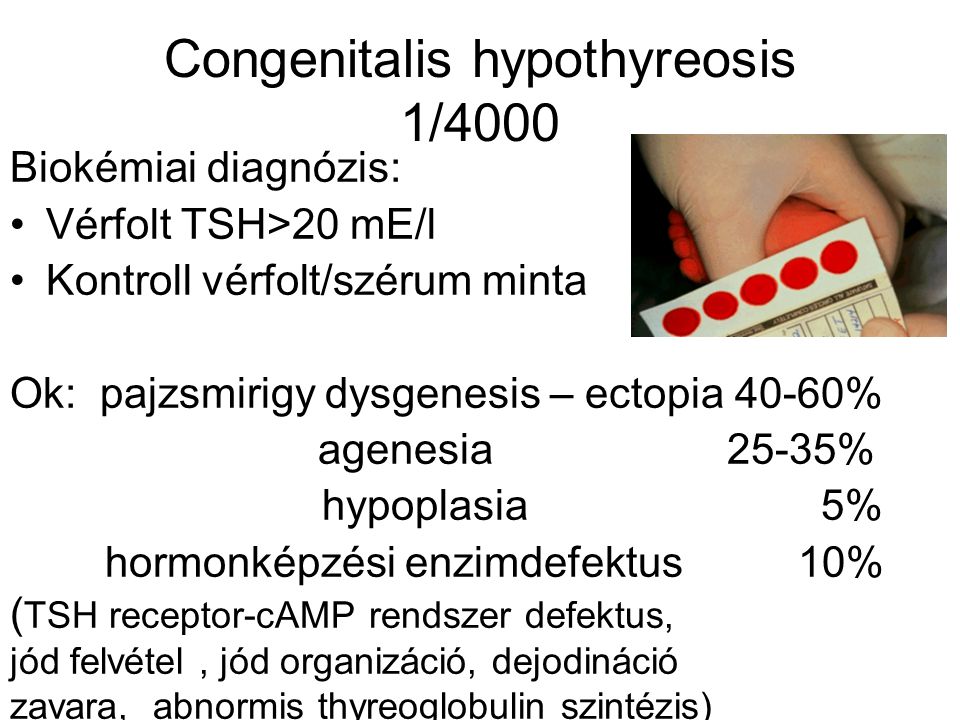 Congenitalis hypothyreosis 1/4000