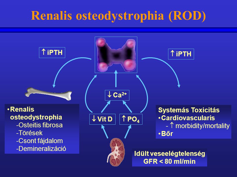 Renalis osteodystrophia (ROD)