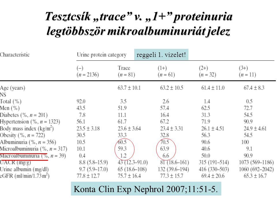 Tesztcsík „trace v. „1+ proteinuria legtöbbször mikroalbuminuriát jelez