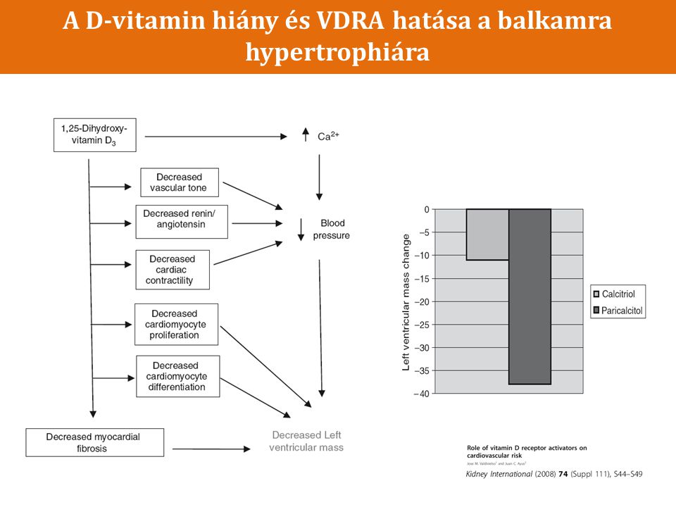 A D-vitamin hiány és VDRA hatása a balkamra hypertrophiára