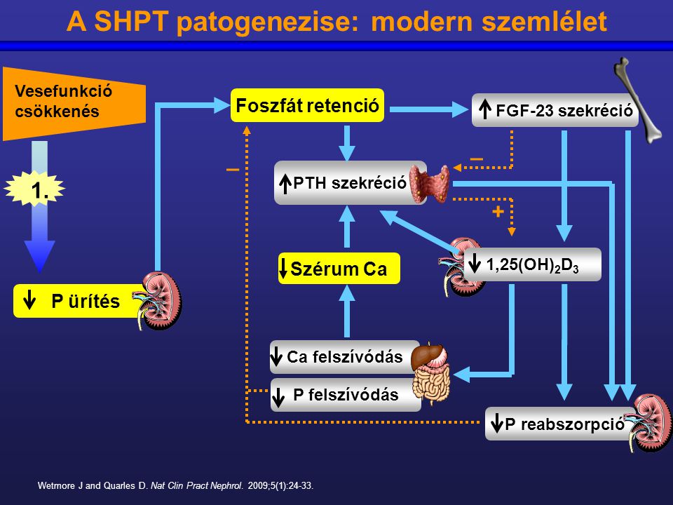 A SHPT patogenezise: modern szemlélet
