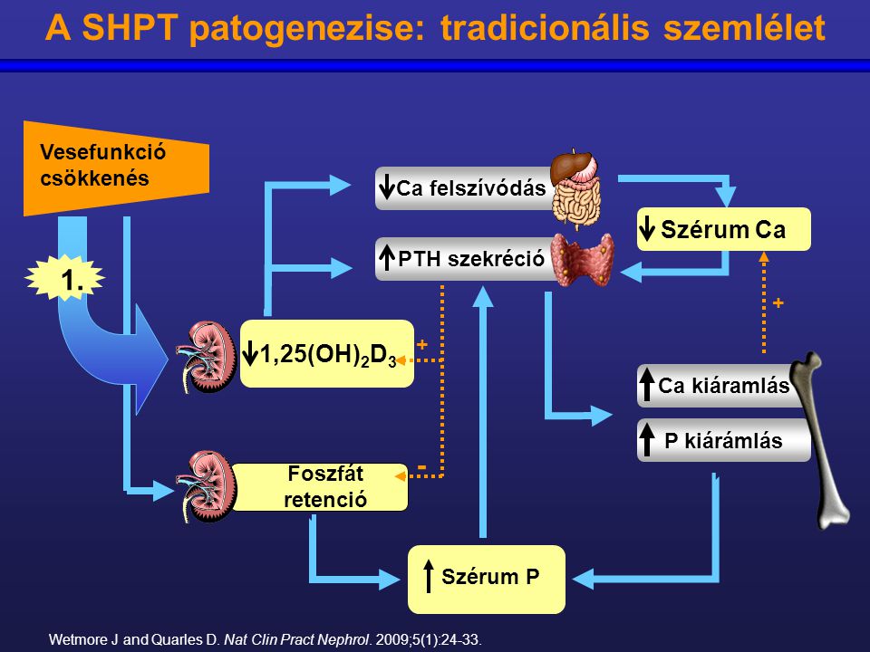 A SHPT patogenezise: tradicionális szemlélet