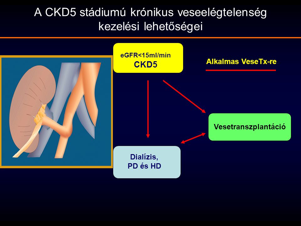 A CKD5 stádiumú krónikus veseelégtelenség kezelési lehetőségei