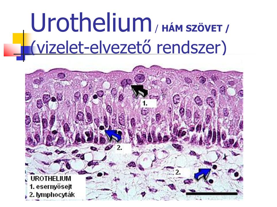Urothelium / HÁM SZÖVET / (vizelet-elvezető rendszer)