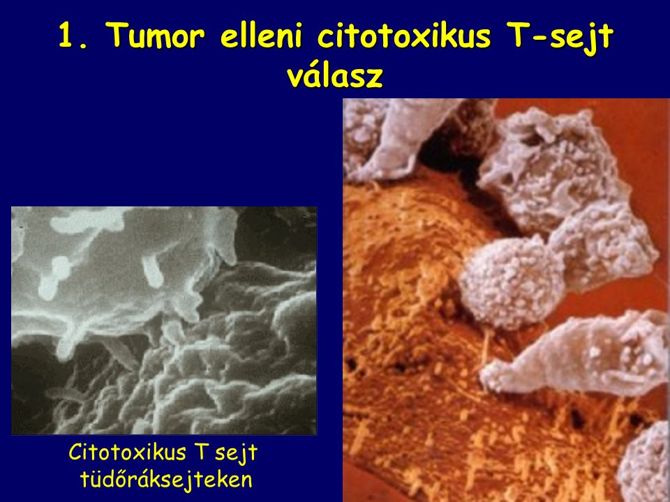 1. Tumor elleni citotoxikus T-sejt válasz