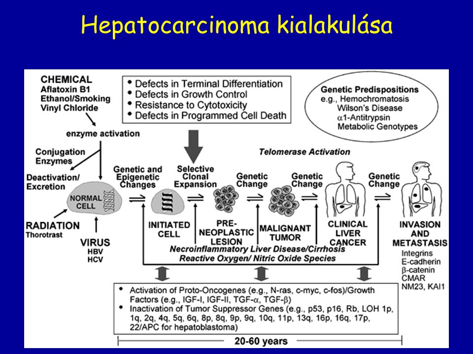 Hepatocarcinoma kialakulása