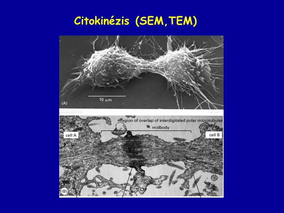 Citokinézis (SEM,TEM)