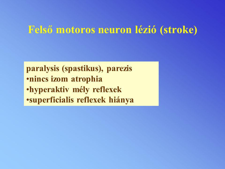 Felső motoros neuron lézió (stroke)