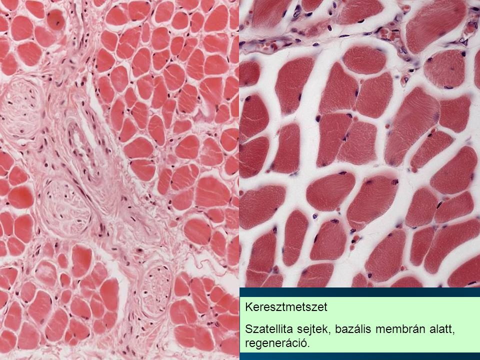 Keresztmetszet Szatellita sejtek, bazális membrán alatt, regeneráció.