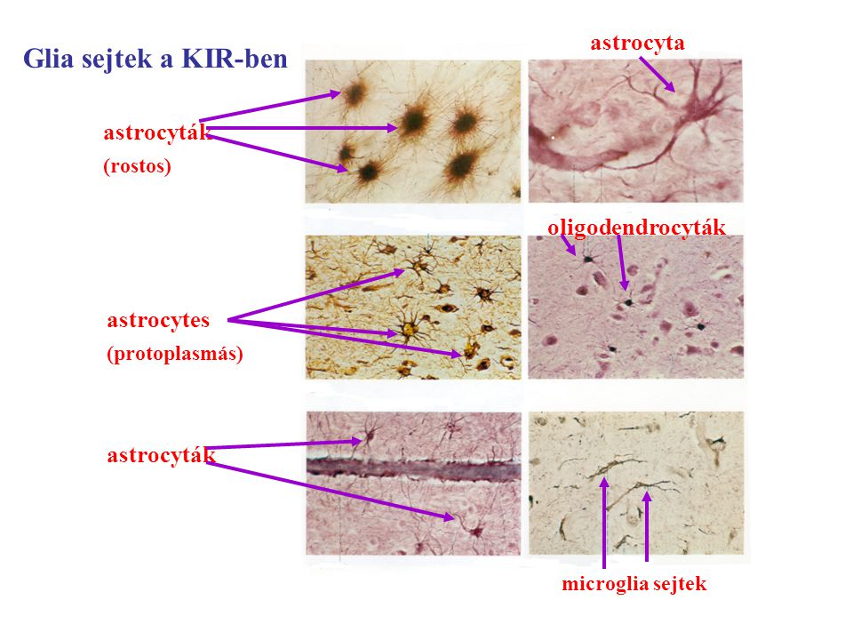Glia sejtek a KIR-ben astrocyta astrocyták oligodendrocyták astrocytes