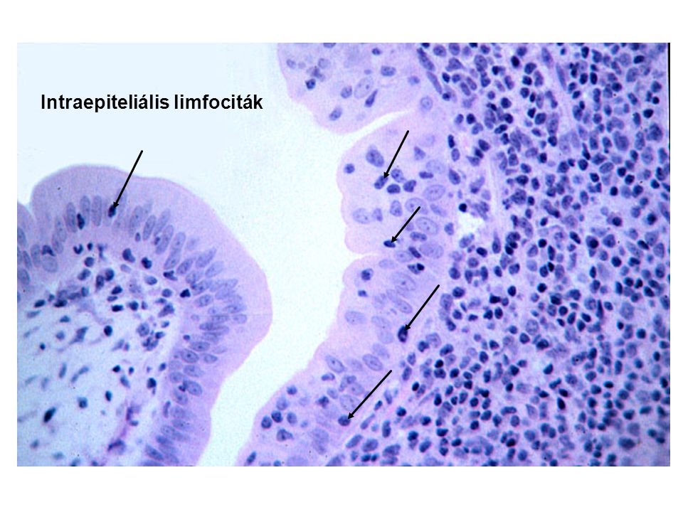 Intraepiteliális limfociták