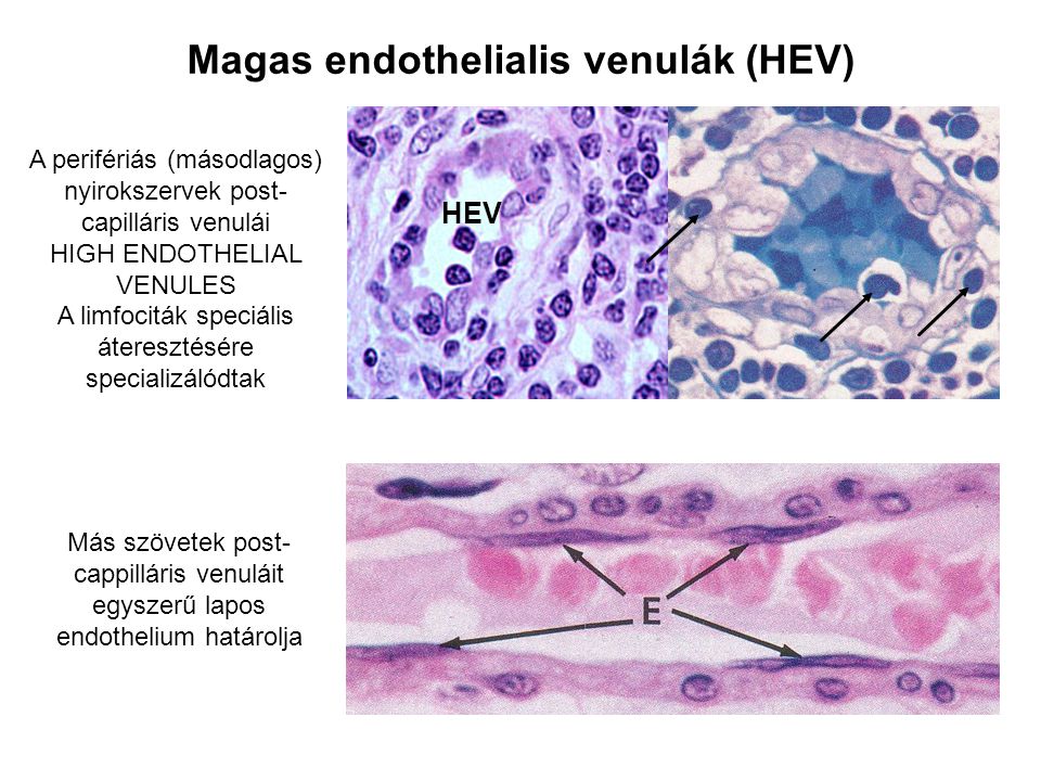 Magas endothelialis venulák (HEV)