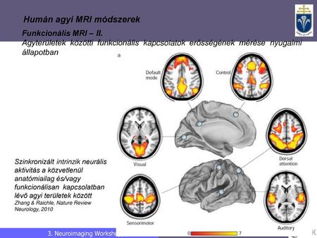 Humán agyi MRI módszerek