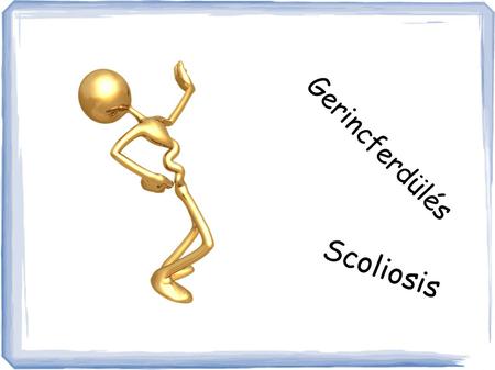 Gerincferdülés Scoliosis.