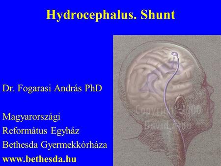 Hydrocephalus. Shunt Dr. Fogarasi András PhD Magyarországi