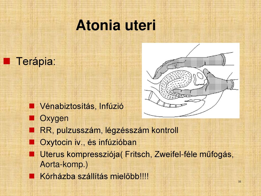 Atonia uteri Terápia: Vénabiztosítás, Infúzió Oxygen
